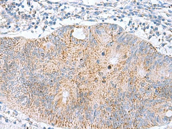 Polyclonal Rabbit anti-Human GCSH Antibody (IHC)