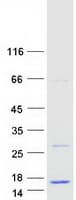 Human LOC284912 Protein (Recombinant Myc-DDK (Flag))