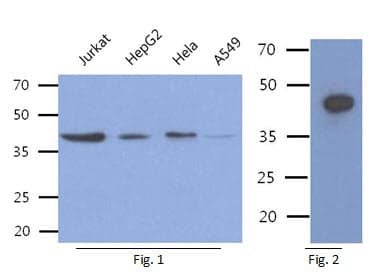 ACY1 / Aminoacylase 1 Antibody (clone AT1E2)