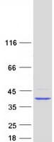 Human HDS / DHDDS Protein (Recombinant Myc-DDK (Flag))