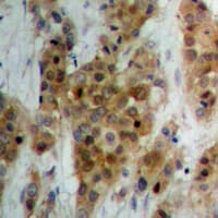 ATXN1 / SCA1 Antibody (C-Terminus)