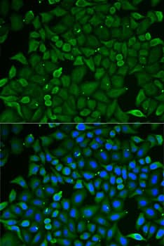 Polyclonal Rabbit anti-Human CARS1 / CARS Antibody (IHC, IF, WB)