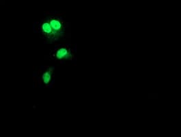 RAD51B Antibody (clone OTI7H4)