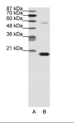 Polyclonal Rabbit anti-Human CBX3 / HP1 Gamma Antibody (aa61-110, IHC, WB)