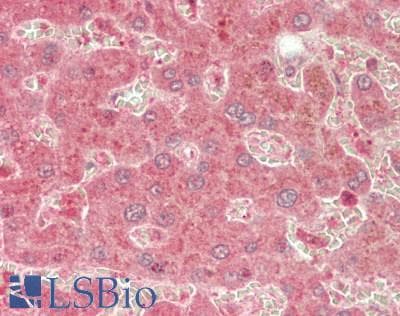 ABCB2 / TAP1 Antibody (aa504-553)