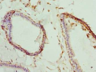 Polyclonal Rabbit anti-Human BNIP2 Antibody (IHC)