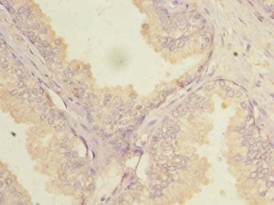 NOL6 / NRAP Antibody