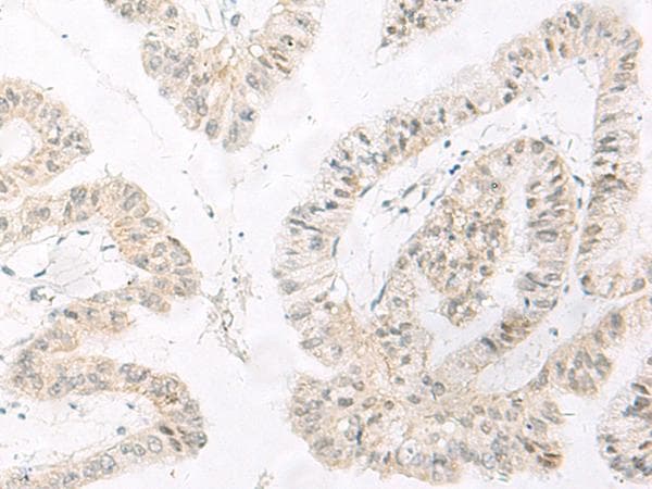 HABP4 Antibody