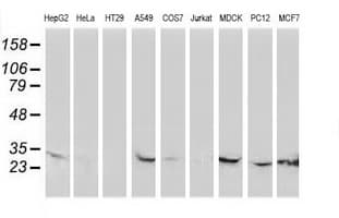 CTDSP1 / SCP1 Antibody (clone OTI1D3)