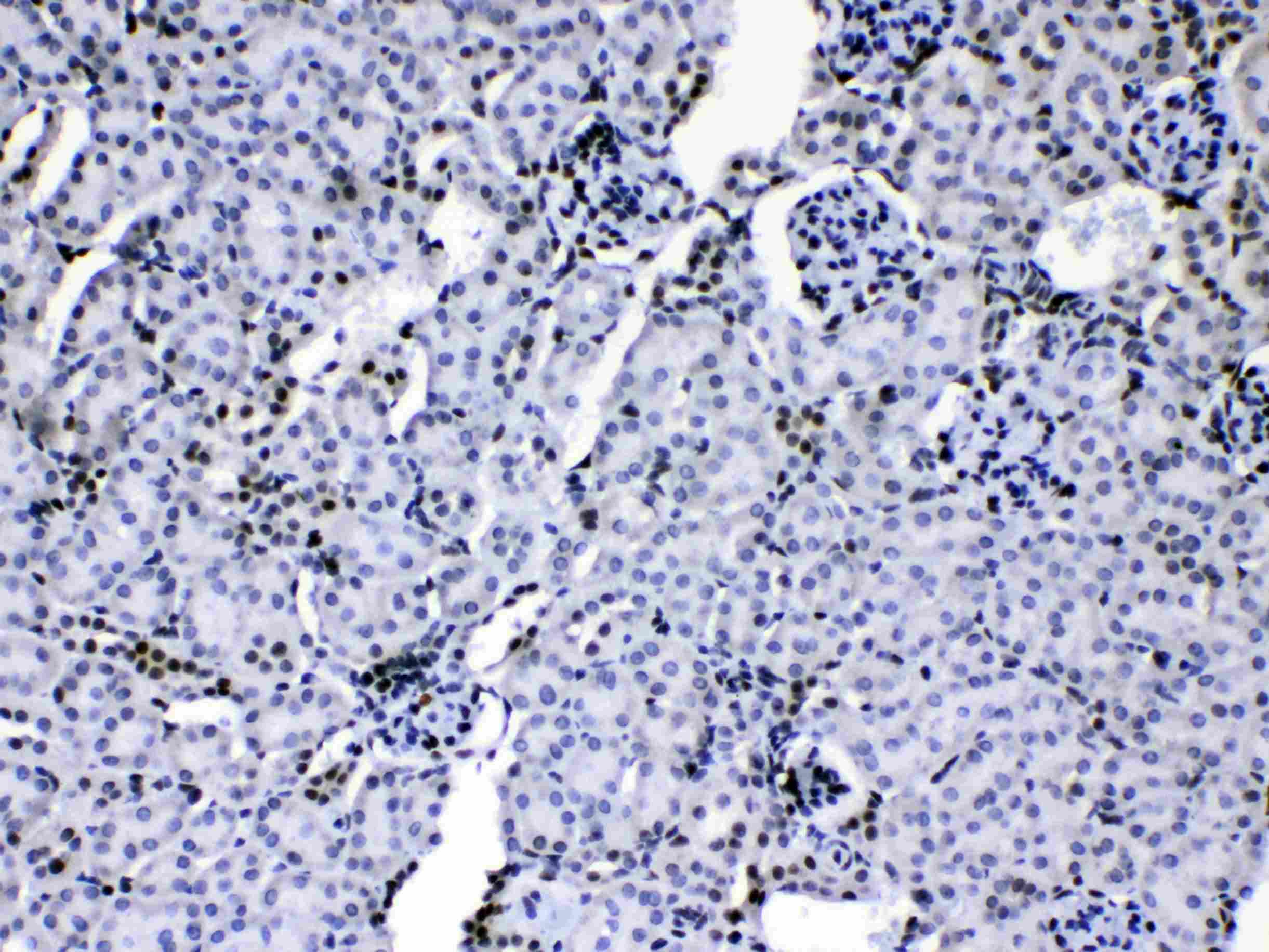 HNRPA1 / HnRNP A1 Antibody