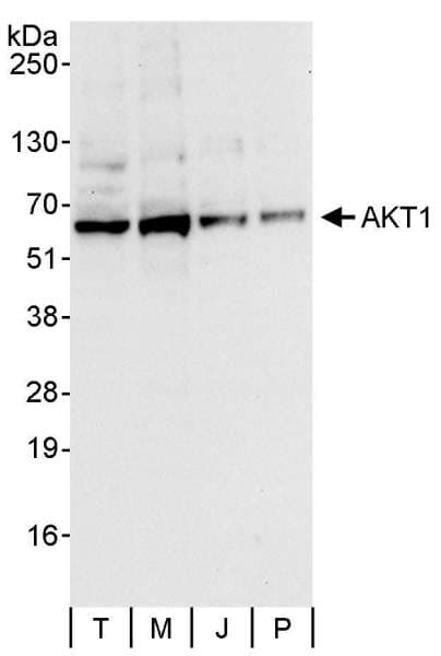 AKT1 Antibody (aa25-75)