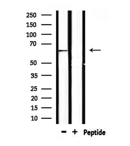 AIFM1 / AIF / PDCD8 Antibody