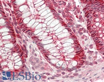 IHC-plus™ EPCAM Antibody (aa27-59, clone VU-1D9)