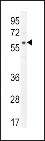 AKT1 Antibody (aa428-457)