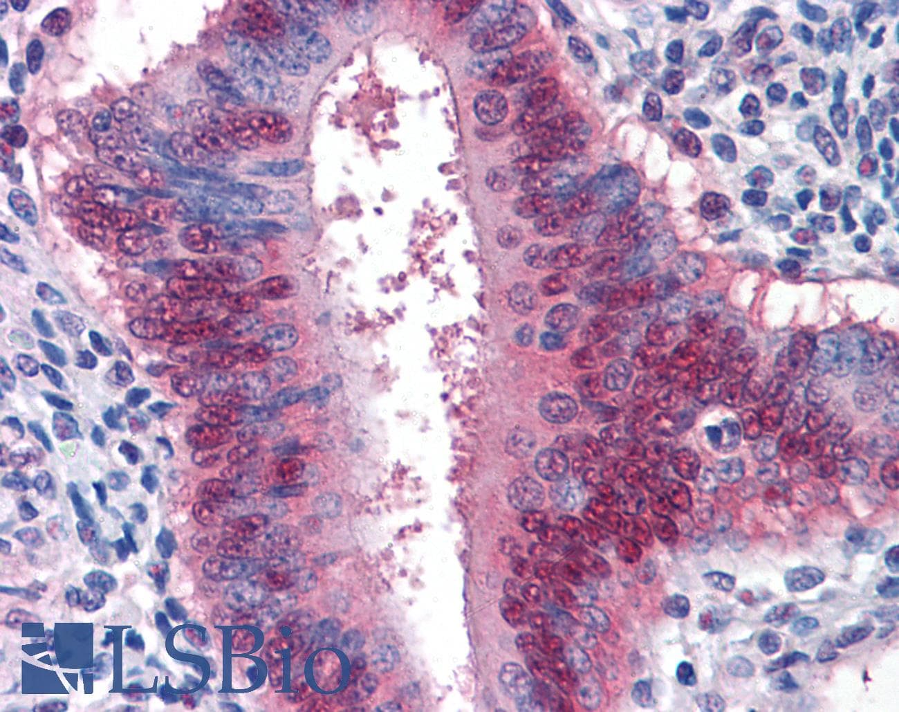 IHC-plus™ Monoclonal Mouse anti-Human YAP / YAP1 Antibody (clone 2F12, IHC, IF, WB)