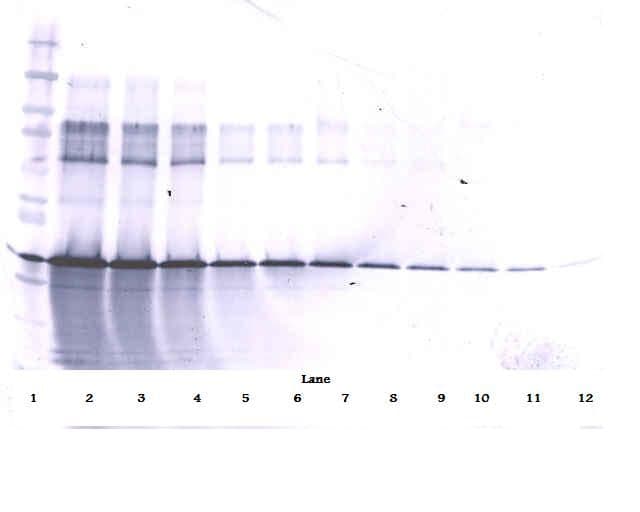 IHC-plus™ IGFBP3 Antibody