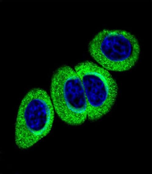 Polyclonal Rabbit anti-Human ATM Antibody (phospho-Ser1981, IF)