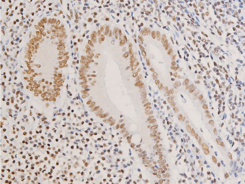 NR3C1/Glucocorticoid Receptor Antibody (phospho-Ser226)