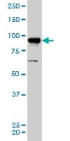 AKAP8 / AKAP95 Antibody (clone 3D4)