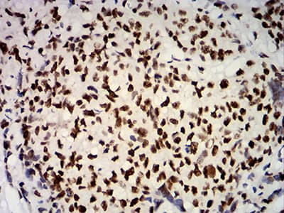 ER Alpha / Estrogen Receptor Antibody (clone 6A6F3)