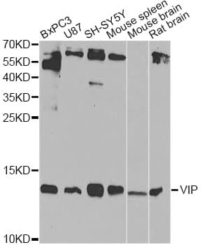 PathPlus™ Polyclonal Rabbit anti-Human VIP Antibody (IHC, WB)