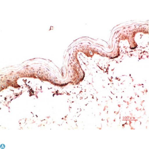 Collagen I Antibody