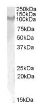IL17RA Antibody (aa353-364)