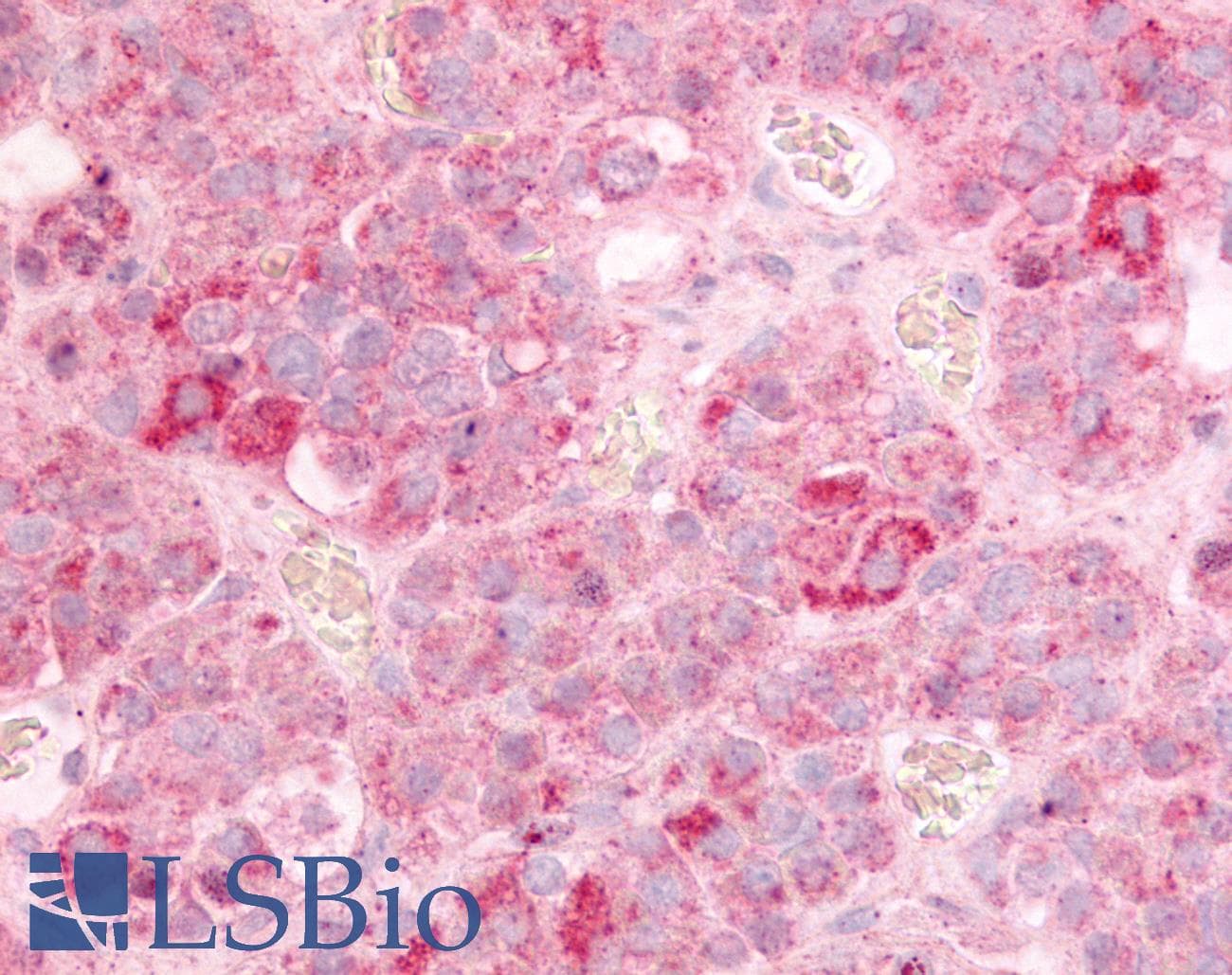 PathPlus™ GPR12 Antibody (N-Terminus)