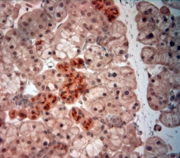 NGF Antibody (aa195-240)