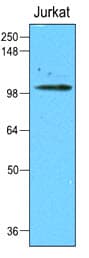 HK2 / Hexokinase 2 Antibody (aa1-917, clone 1A7)