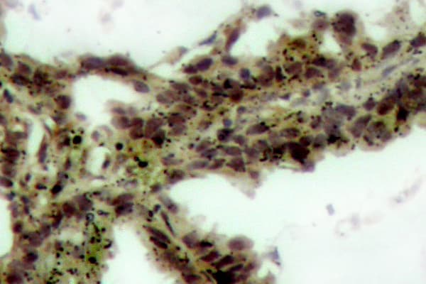 AKT1 + AKT2 + AKT3 Antibody (phospho-Thr308)