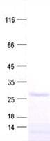 Human C9orf163 Protein (Recombinant His, N-Terminal)