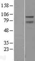 ZBTB5 Protein (Over-Expression Lysate Myc-DDK (Flag))