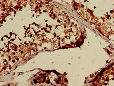 CLTCL1 / CHC22 Antibody