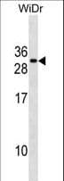 FADD Antibody (aa106-135)