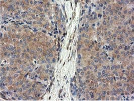 CYB5R3 / B5R Antibody (clone OTI2A10)