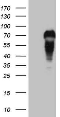 MYCN / N-myc Antibody (aa229-464, clone OTI2A2, Carrier-free)