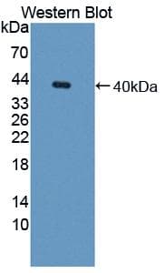 LGALS8 / Galectin 8 Antibody (aa1-316)