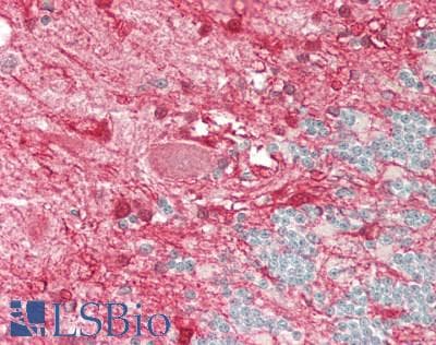 IHC-plus™ PSAT1 Antibody