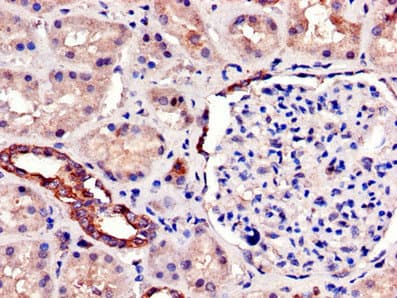 Polyclonal Rabbit anti-Human SIRT7 / Sirtuin 7 Antibody (IHC, IF)