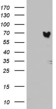 MTDH / Metadherin Antibody (aa70-582, clone OTI2F11)