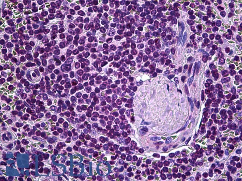 IHC-plus™ ELAC2 Antibody (aa161-210)