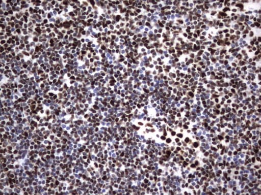 HNRPM / HNRNPM Antibody (aa1-261, clone OTI4C9)