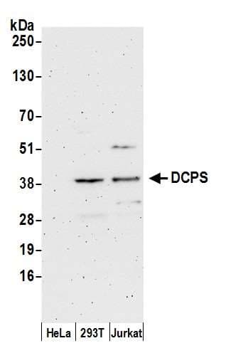 DCPS Antibody (aa287-337)