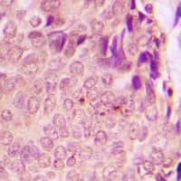 STAT3 Antibody (phospho-Ser727)