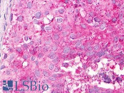 PathPlus™ MLNR/GPR38/Motilin Receptor Antibody (Internal)