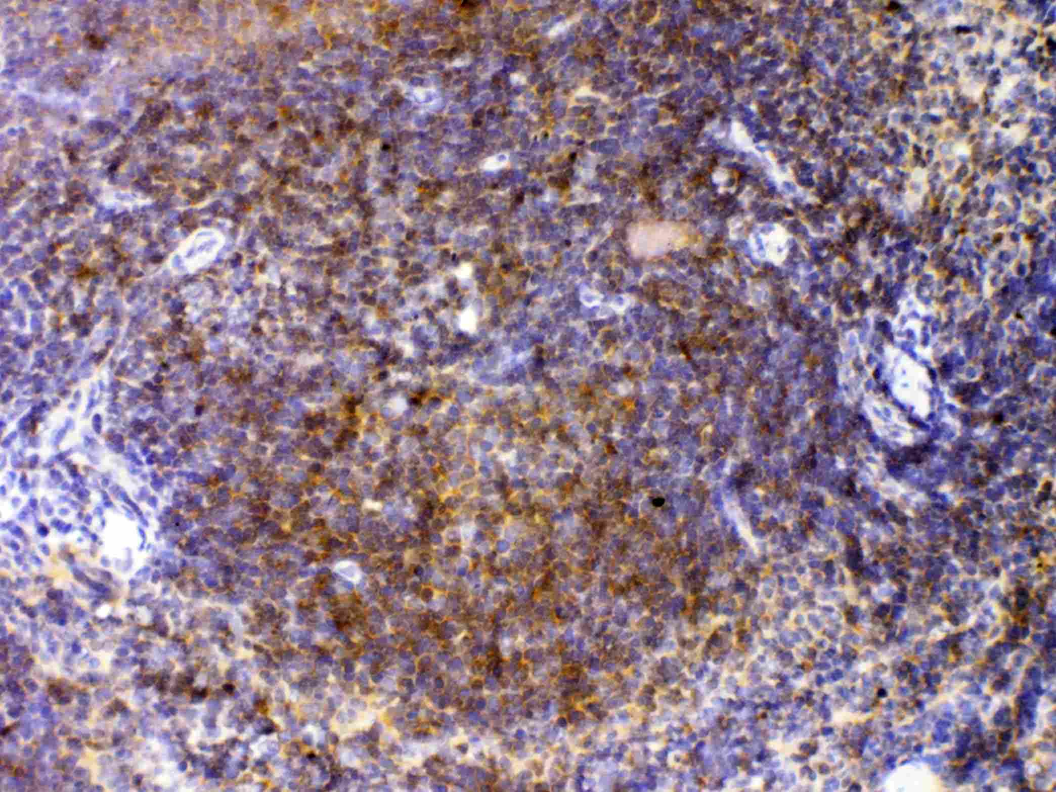 CTLA4 / CD152 Antibody (aa36-161)