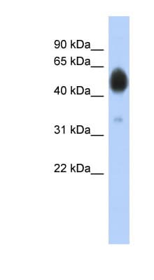 ARSA / Arylsulfatase A Antibody (aa37-86)