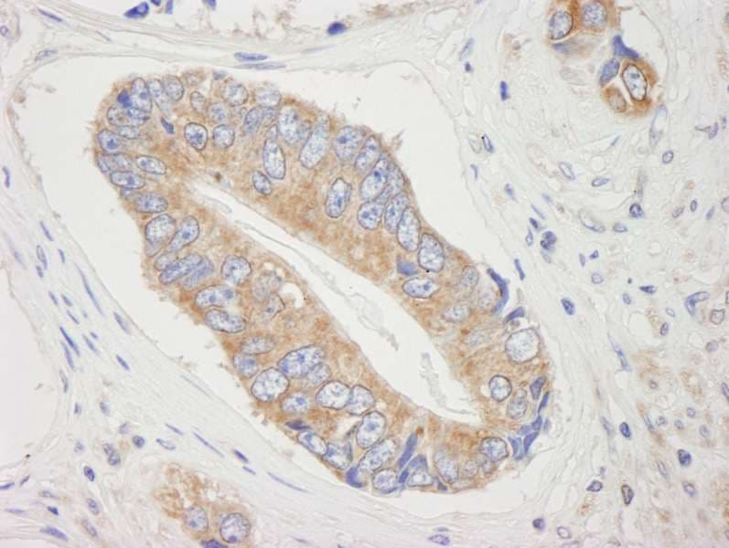 Polyclonal Rabbit anti-Human EIF4ENIF1 / 4E-T Antibody (aa925-C-term, IHC, IF)