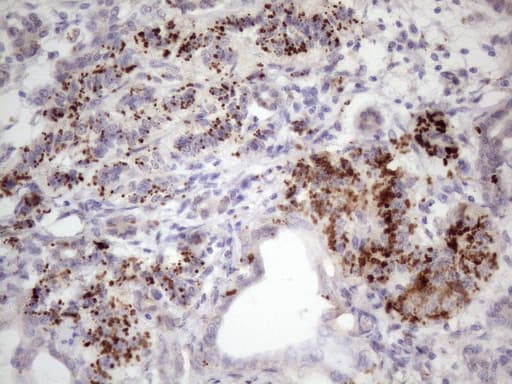 Monoclonal Mouse anti-Human C1orf106 Antibody (clone OTI6A6, aa1-270, IHC, WB)